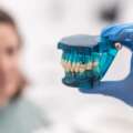 Z czego składa się implant zębowy?